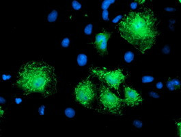 KATNB1 Antibody in Immunocytochemistry (ICC/IF)