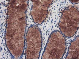 KATNB1 Antibody in Immunohistochemistry (Paraffin) (IHC (P))