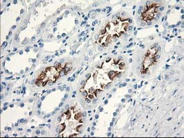 KATNB1 Antibody in Immunohistochemistry (Paraffin) (IHC (P))