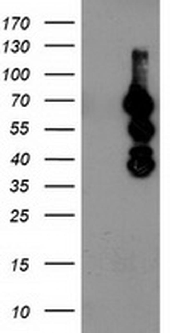 KATNB1 Antibody in Western Blot (WB)