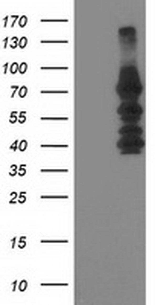 KATNB1 Antibody in Western Blot (WB)