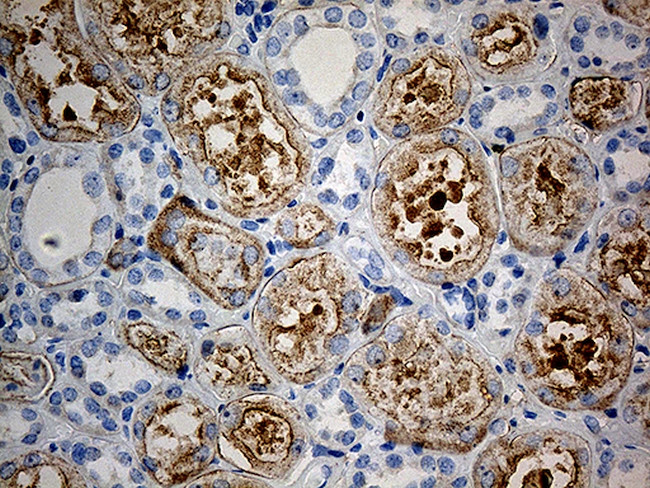 KBTBD4 Antibody in Immunohistochemistry (Paraffin) (IHC (P))