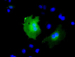 KBTBD7 Antibody in Immunocytochemistry (ICC/IF)