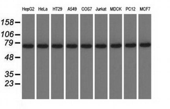 KBTBD7 Antibody in Western Blot (WB)