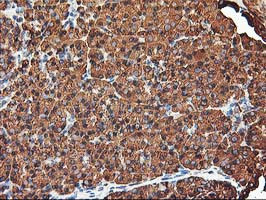 KCNAB1 Antibody in Immunohistochemistry (Paraffin) (IHC (P))