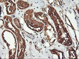 KCNAB1 Antibody in Immunohistochemistry (Paraffin) (IHC (P))