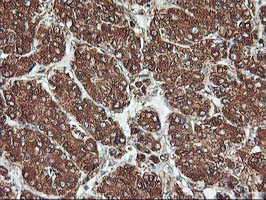 KCNAB1 Antibody in Immunohistochemistry (Paraffin) (IHC (P))