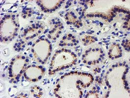 KCNAB1 Antibody in Immunohistochemistry (Paraffin) (IHC (P))