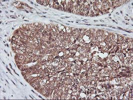 KCNAB1 Antibody in Immunohistochemistry (Paraffin) (IHC (P))