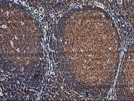 KCNAB1 Antibody in Immunohistochemistry (Paraffin) (IHC (P))