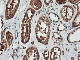 KCNAB1 Antibody in Immunohistochemistry (Paraffin) (IHC (P))