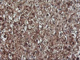 KCNAB1 Antibody in Immunohistochemistry (Paraffin) (IHC (P))