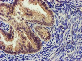 KCNAB1 Antibody in Immunohistochemistry (Paraffin) (IHC (P))