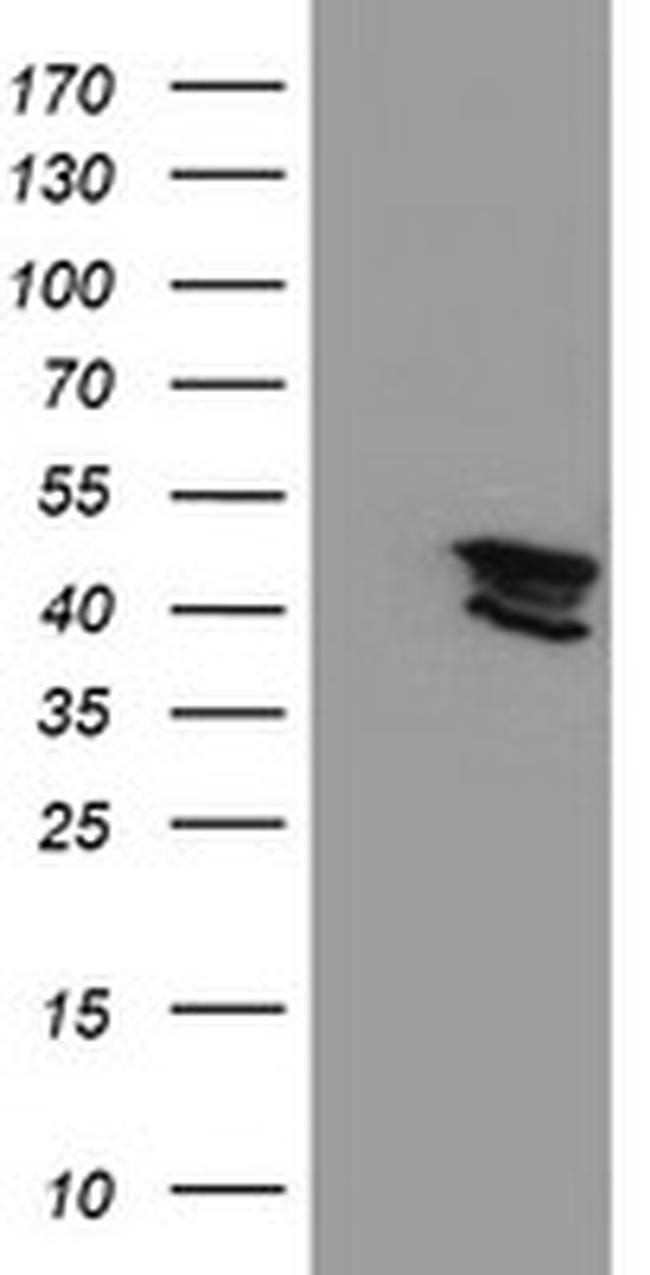 KCNAB1 Antibody in Western Blot (WB)