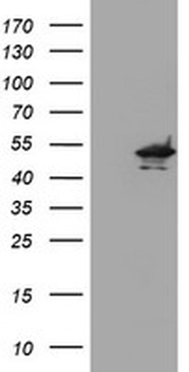 KCNAB1 Antibody in Western Blot (WB)