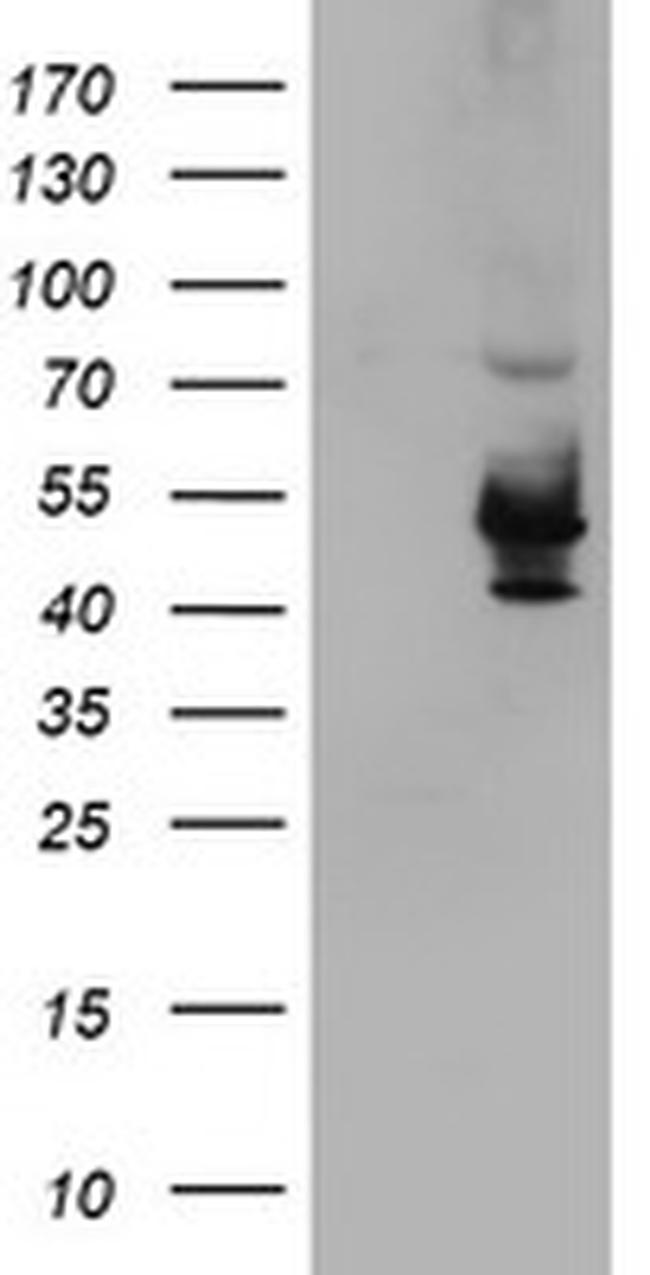 KCNAB1 Antibody in Western Blot (WB)