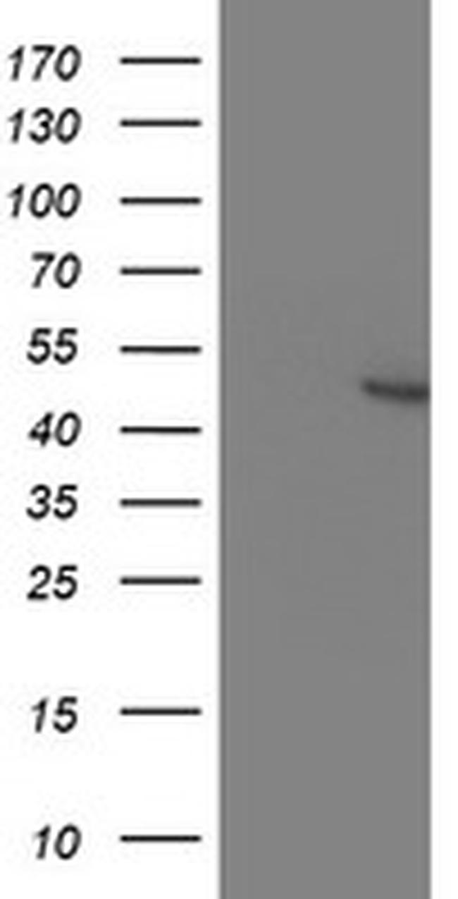 KCNAB1 Antibody in Western Blot (WB)