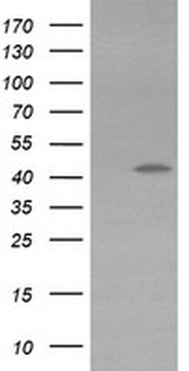 KCNAB1 Antibody in Western Blot (WB)