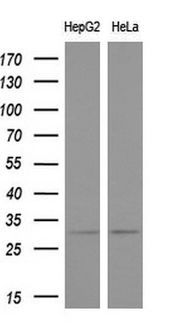 KCNIP2 Antibody in Western Blot (WB)