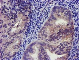 KCNJ3 Antibody in Immunohistochemistry (Paraffin) (IHC (P))