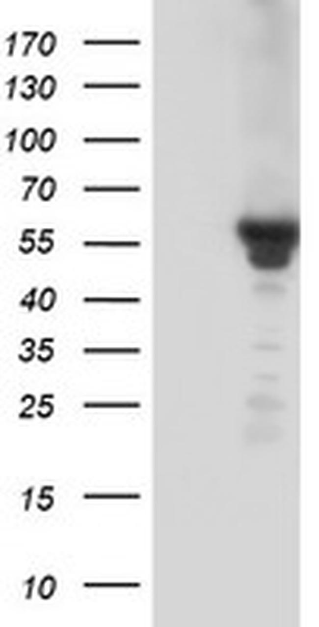 KCNJ3 Antibody in Western Blot (WB)