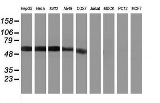 KCNJ3 Antibody in Western Blot (WB)