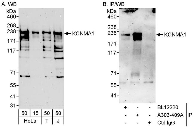 KCNMA1 Antibody in Western Blot (WB)