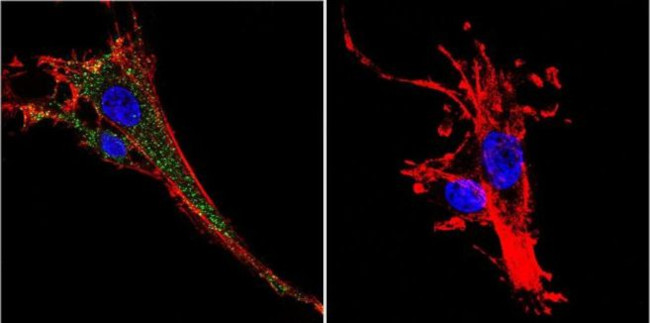 KCNQ2 Antibody in Immunocytochemistry (ICC/IF)