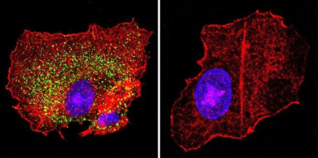 KCNQ2 Antibody in Immunocytochemistry (ICC/IF)