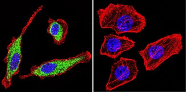 KCNQ2 Antibody in Immunocytochemistry (ICC/IF)