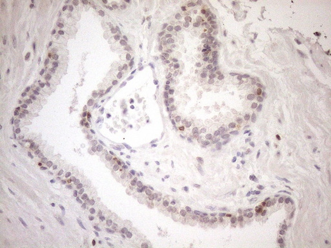 KCTD13 Antibody in Immunohistochemistry (Paraffin) (IHC (P))