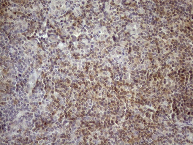 KCTD13 Antibody in Immunohistochemistry (Paraffin) (IHC (P))