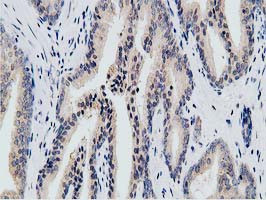 KCTD14 Antibody in Immunohistochemistry (Paraffin) (IHC (P))