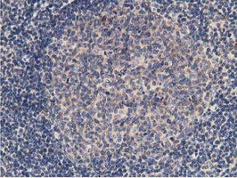 KCTD14 Antibody in Immunohistochemistry (Paraffin) (IHC (P))