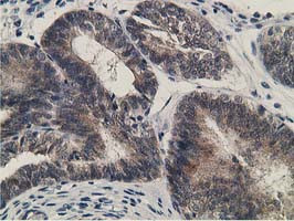 KCTD14 Antibody in Immunohistochemistry (Paraffin) (IHC (P))