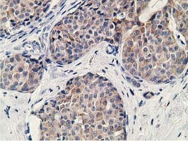 KCTD14 Antibody in Immunohistochemistry (Paraffin) (IHC (P))