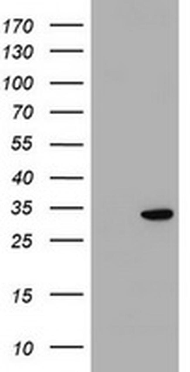 KCTD14 Antibody in Western Blot (WB)