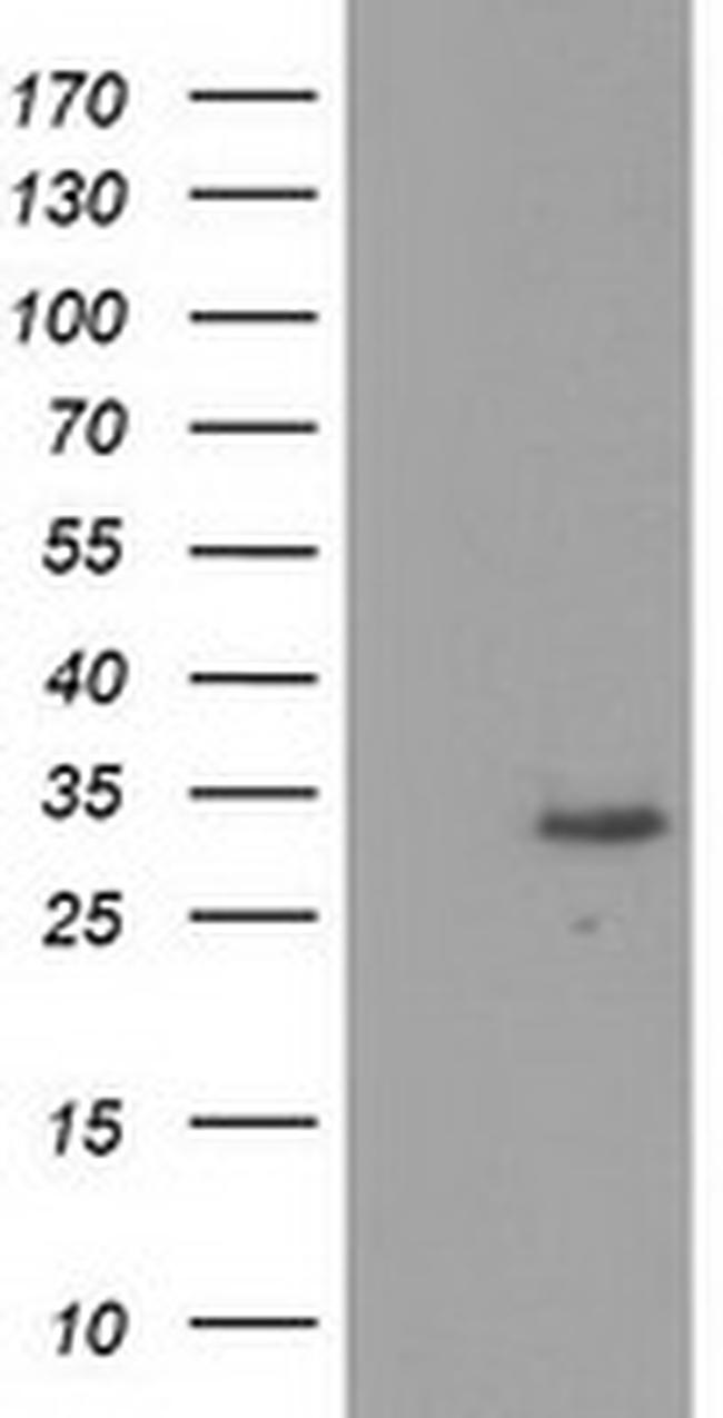 KCTD14 Antibody in Western Blot (WB)