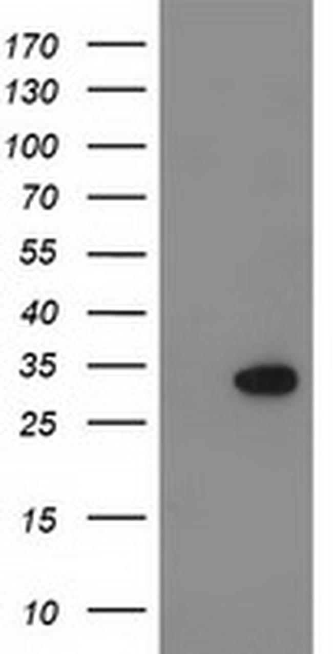 KCTD14 Antibody in Western Blot (WB)