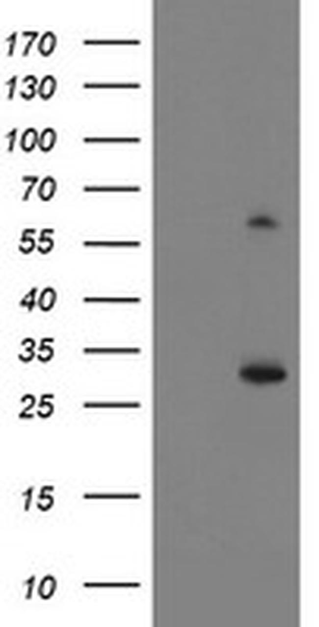 KCTD14 Antibody in Western Blot (WB)