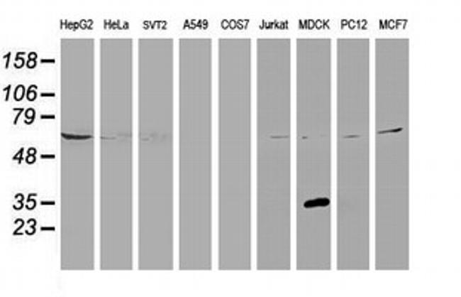 KCTD14 Antibody in Western Blot (WB)