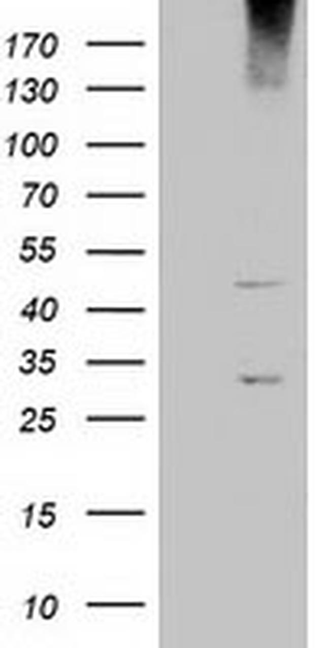 KCTD14 Antibody in Western Blot (WB)