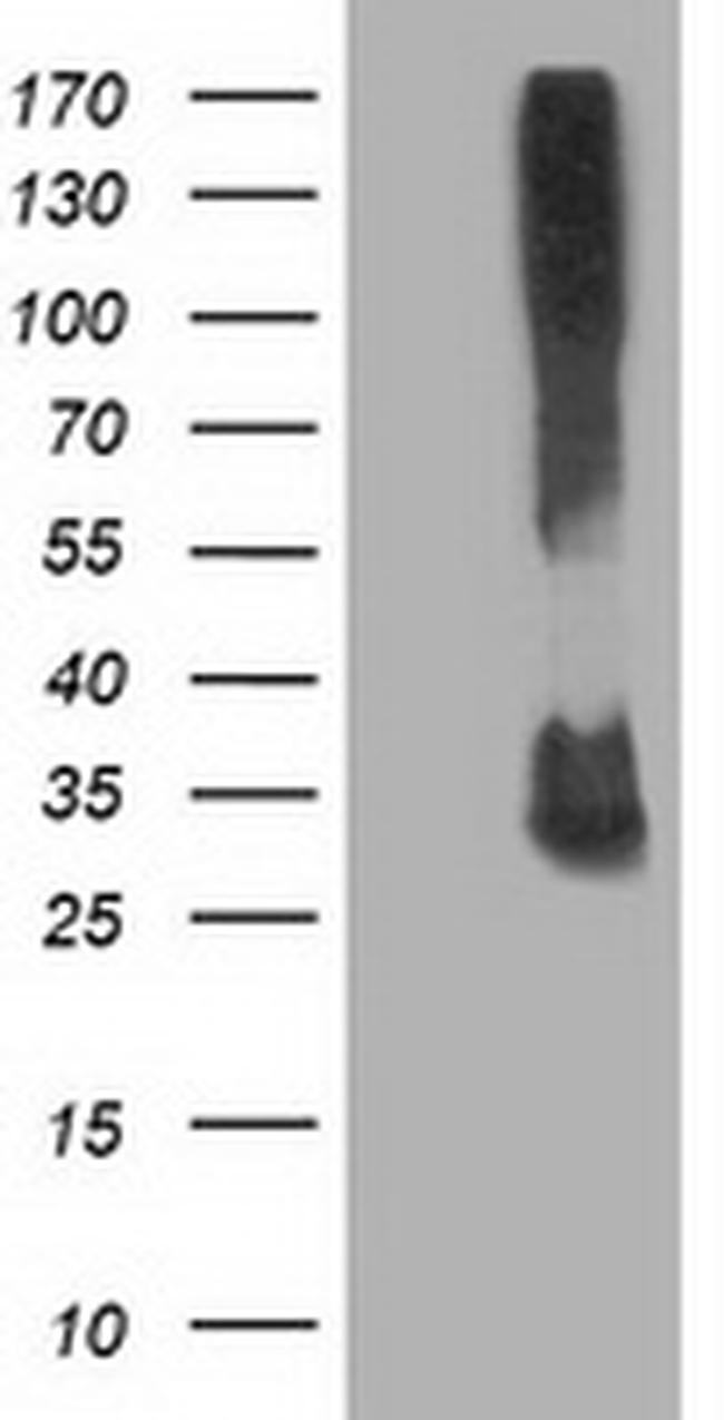 KCTD14 Antibody in Western Blot (WB)