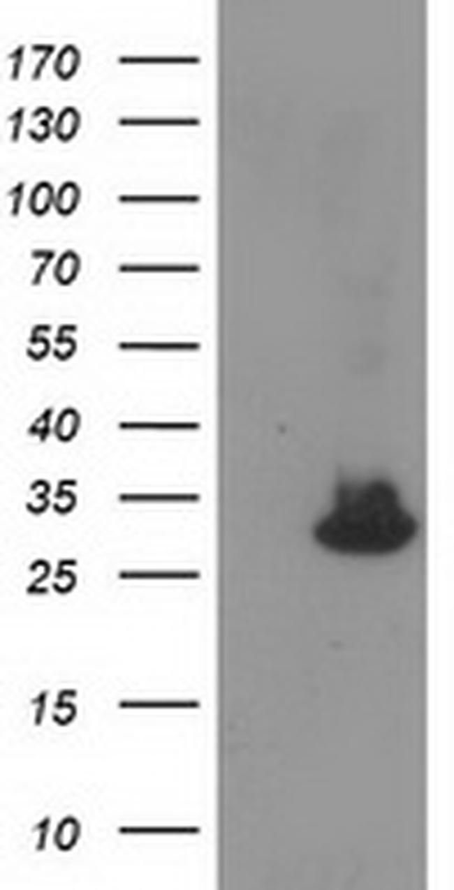 KCTD14 Antibody in Western Blot (WB)