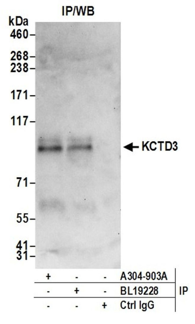 KCTD3 Antibody in Immunoprecipitation (IP)