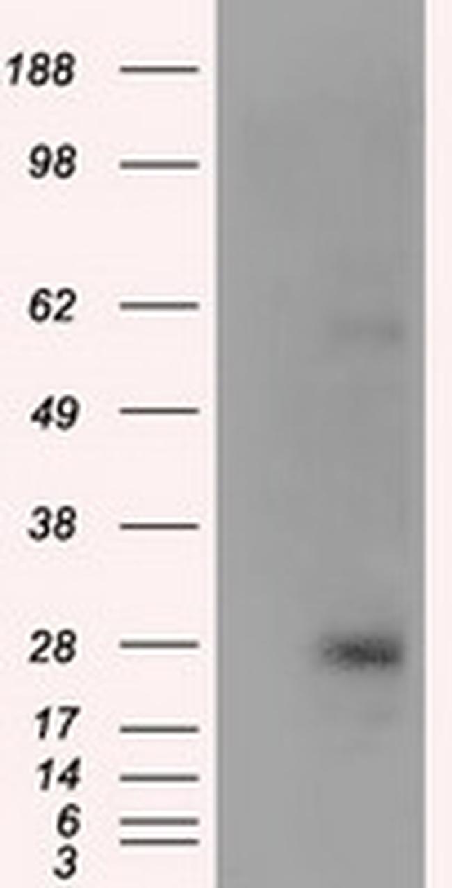 KCTD5 Antibody in Western Blot (WB)