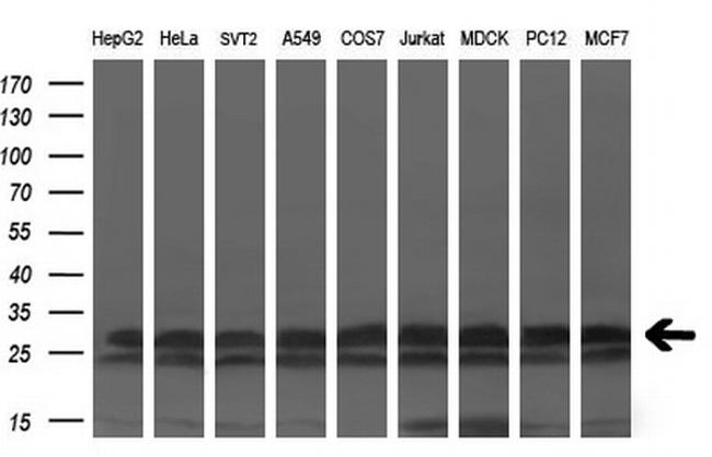 KCTD5 Antibody in Western Blot (WB)