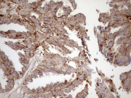 KCTD9 Antibody in Immunohistochemistry (Paraffin) (IHC (P))