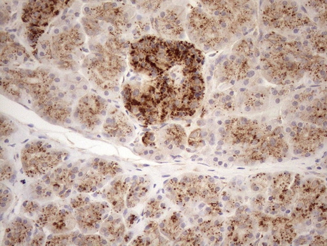 KCTD9 Antibody in Immunohistochemistry (Paraffin) (IHC (P))