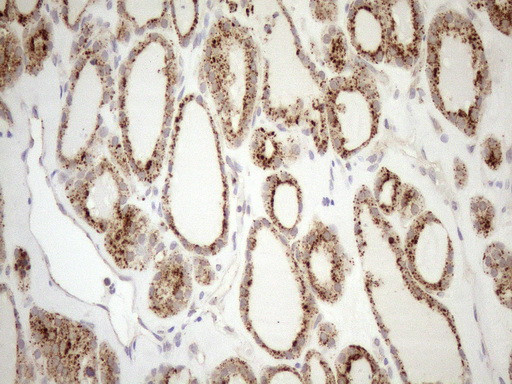 KCTD9 Antibody in Immunohistochemistry (Paraffin) (IHC (P))